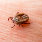 How to Prevent, Treat and Remove Ticks Safely